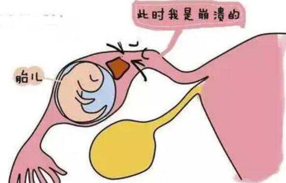 广州代孕产子公司微信 广州成功率较高的正规试管医院 ‘酒精测男女一开始一