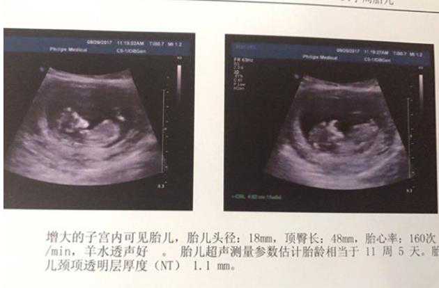 广州哪有提供供卵的机构 在广州做试管婴儿最好的私立医院是什么？如何选择