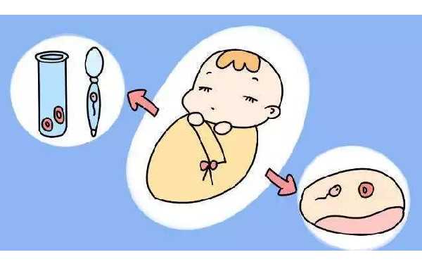 广州代孕价格哪家好 广州第三代试管婴儿多少钱 ‘孕囊尺寸三个数据图解看男