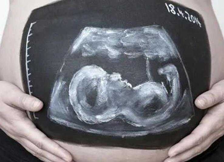 50岁广州借卵成功率多少 广州正规生殖医院列表 ‘2个月的胎儿彩超图看男女’