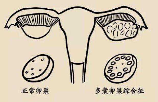 广州助孕妈及捐卵价格 哪些不孕的情况可以进行广州试管婴儿广州做试管婴儿