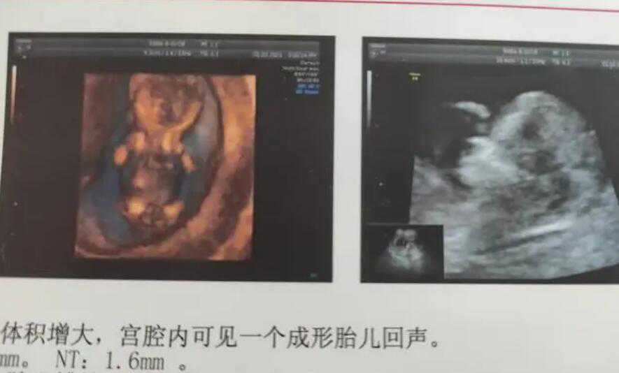 广州借卵子生子的规定-江门借卵子医院